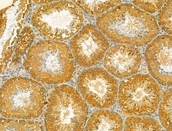 Invitrogen HRD1 Polyclonal Antibody 100 &mu;L; Unconjugated:Antibodies,