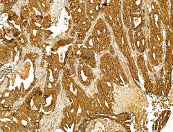 Invitrogen HRD1 Polyclonal Antibody 100 &mu;L; Unconjugated:Antibodies,