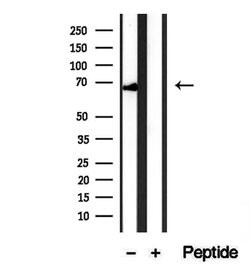 Invitrogen HRD1 Polyclonal Antibody 100 &mu;L; Unconjugated:Antibodies,