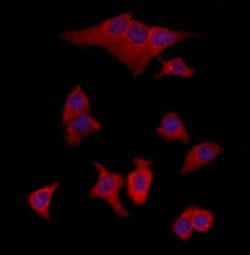 Invitrogen TMOD4 Polyclonal Antibody 100 &mu;L; Unconjugated:Antibodies,