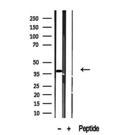 Invitrogen TMOD4 Polyclonal Antibody 100 &mu;L; Unconjugated:Antibodies,