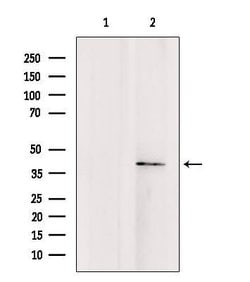 Invitrogen TMOD4 Polyclonal Antibody 100 &mu;L; Unconjugated:Antibodies,