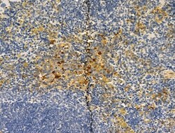 Invitrogen TOMM40 Polyclonal Antibody 100 &mu;L; Unconjugated:Antibodies,