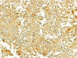 Invitrogen TOMM40 Polyclonal Antibody 100 &mu;L; Unconjugated:Antibodies,