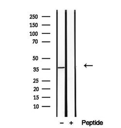 Invitrogen TOMM40 Polyclonal Antibody 100 &mu;L; Unconjugated:Antibodies,
