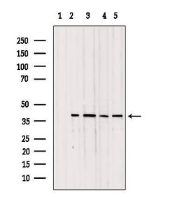 Invitrogen TOMM40 Polyclonal Antibody 100 &mu;L; Unconjugated:Antibodies,