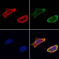 Invitrogen VNN1 Polyclonal Antibody 100 &mu;L; Unconjugated:Antibodies,
