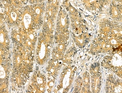 Invitrogen VNN1 Polyclonal Antibody 100 &mu;L; Unconjugated:Antibodies,