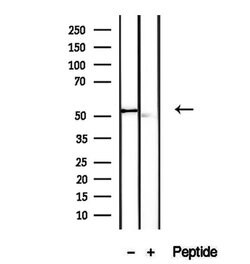 Invitrogen VNN1 Polyclonal Antibody 100 &mu;L; Unconjugated:Antibodies,