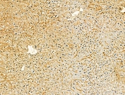 Invitrogen VPS16 Polyclonal Antibody 100 &mu;L; Unconjugated:Antibodies,