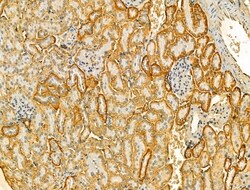 Invitrogen VPS16 Polyclonal Antibody 100 &mu;L; Unconjugated:Antibodies,