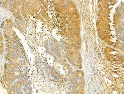 Invitrogen VPS16 Polyclonal Antibody 100 &mu;L; Unconjugated:Antibodies,