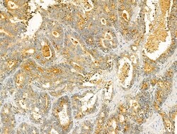 Invitrogen VPS16 Polyclonal Antibody 100 &mu;L; Unconjugated:Antibodies,