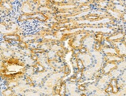 Invitrogen VPS16 Polyclonal Antibody 100 &mu;L; Unconjugated:Antibodies,