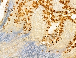 Invitrogen VPS16 Polyclonal Antibody 100 &mu;L; Unconjugated:Antibodies,