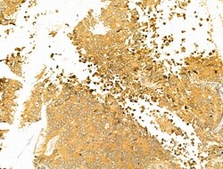 Invitrogen VPS37A Polyclonal Antibody 100 &mu;L | Buy Online | Invitrogen&trade; | Fisher Scientific