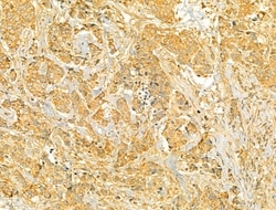 Invitrogen VPS37A Polyclonal Antibody 100 &mu;L | Buy Online | Invitrogen&trade; | Fisher Scientific