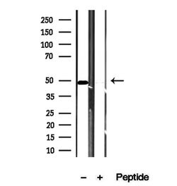 Invitrogen VPS37A Polyclonal Antibody 100 &mu;L | Buy Online | Invitrogen&trade; | Fisher Scientific
