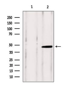Invitrogen VPS37A Polyclonal Antibody 100 &mu;L | Buy Online | Invitrogen&trade; | Fisher Scientific