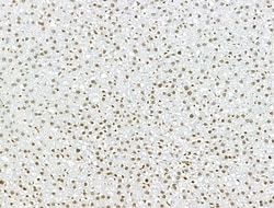 Invitrogen AEBP2 Polyclonal Antibody 100 &mu;L | Buy Online | Invitrogen&trade; | Fisher Scientific