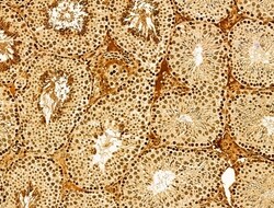 Invitrogen AEBP2 Polyclonal Antibody 100 &mu;L | Buy Online | Invitrogen&trade; | Fisher Scientific