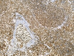 Invitrogen AEBP2 Polyclonal Antibody 100 &mu;L | Buy Online | Invitrogen&trade; | Fisher Scientific