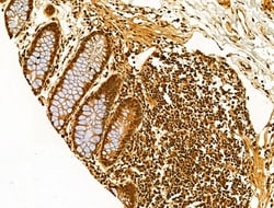 Invitrogen AEBP2 Polyclonal Antibody 100 &mu;L | Buy Online | Invitrogen&trade; | Fisher Scientific