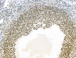 Invitrogen AEBP2 Polyclonal Antibody 100 &mu;L | Buy Online | Invitrogen&trade; | Fisher Scientific