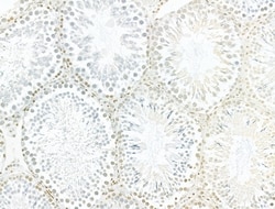 Invitrogen AEBP2 Polyclonal Antibody 100 &mu;L | Buy Online | Invitrogen&trade; | Fisher Scientific