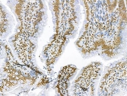 Invitrogen AEBP2 Polyclonal Antibody 100 &mu;L | Buy Online | Invitrogen&trade; | Fisher Scientific