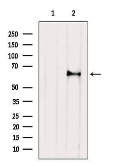 Invitrogen ASAH1 Polyclonal Antibody 100 &mu;L | Buy Online | Invitrogen&trade; | Fisher Scientific