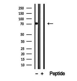 Invitrogen CCDC22 Polyclonal Antibody 100 &mu;L; Unconjugated:Antibodies,
