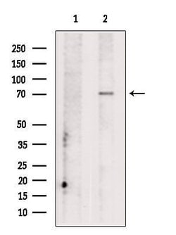 Invitrogen CCDC22 Polyclonal Antibody 100 &mu;L; Unconjugated:Antibodies,