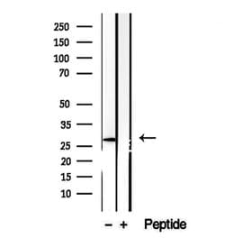 Invitrogen CHMP4B Polyclonal Antibody 100 &mu;L; Unconjugated:Antibodies,