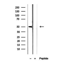Invitrogen CREST Polyclonal Antibody 100 &mu;L; Unconjugated:Antibodies,