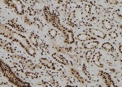 Invitrogen DBR1 Polyclonal Antibody 100 &mu;L; Unconjugated:Antibodies,