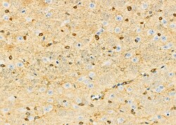 Invitrogen DBR1 Polyclonal Antibody 100 &mu;L; Unconjugated:Antibodies,