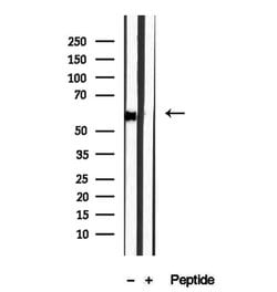 Invitrogen DBR1 Polyclonal Antibody 100 &mu;L; Unconjugated:Antibodies,