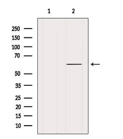 Invitrogen DBR1 Polyclonal Antibody 100 &mu;L; Unconjugated:Antibodies,