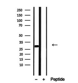 Invitrogen DNAJB3 Polyclonal Antibody 100 &mu;L; Unconjugated:Antibodies,