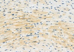 Invitrogen FSTL1 Polyclonal Antibody 100 &mu;L | Buy Online | Invitrogen&trade; | Fisher Scientific