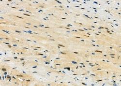 Invitrogen HDGFRP2 Polyclonal Antibody 100 &mu;L; Unconjugated:Antibodies,