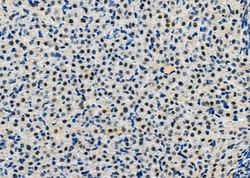 Invitrogen HDGFRP2 Polyclonal Antibody 100 &mu;L; Unconjugated:Antibodies,
