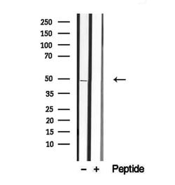 Invitrogen Activin A Polyclonal Antibody 100 &mu;L; Unconjugated:Antibodies,