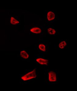 Invitrogen MAGOH Polyclonal Antibody 100 &mu;L | Buy Online | Invitrogen&trade; | Fisher Scientific