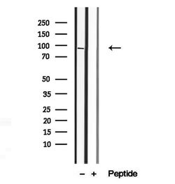 Invitrogen MAGOH Polyclonal Antibody 100 &mu;L | Buy Online | Invitrogen&trade; | Fisher Scientific