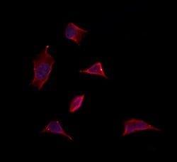 Invitrogen MDH1 Polyclonal Antibody 100 &mu;L; Unconjugated:Antibodies,