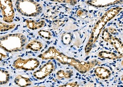 Invitrogen MDH1 Polyclonal Antibody 100 &mu;L; Unconjugated:Antibodies,