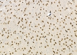 Invitrogen MEPCE Polyclonal Antibody 100 &mu;L; Unconjugated:Antibodies,