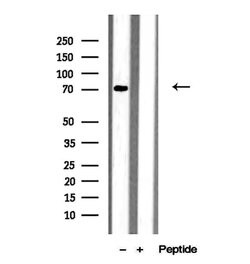 Invitrogen MEPCE Polyclonal Antibody 100 &mu;L; Unconjugated:Antibodies,